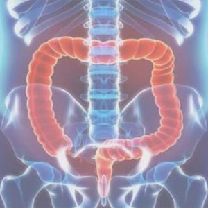 Mire jó a béltisztítás, és hogyan végezzük el?