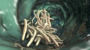 Paraziták az emberi szervezetben