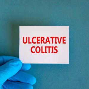 Colitis Ulcerosa
